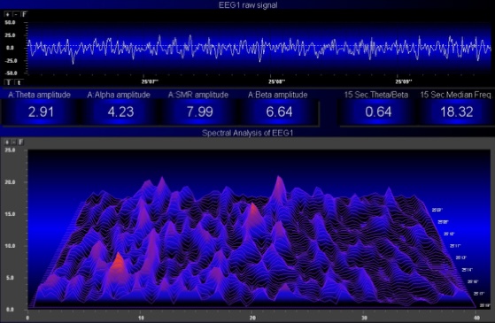 EEG reading before a Lucia Light session