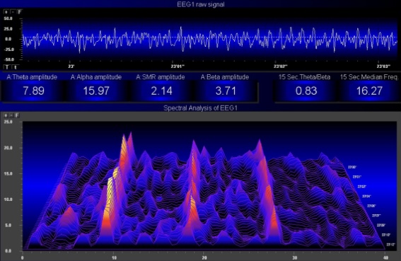 EEG reading during a Lucia Light session